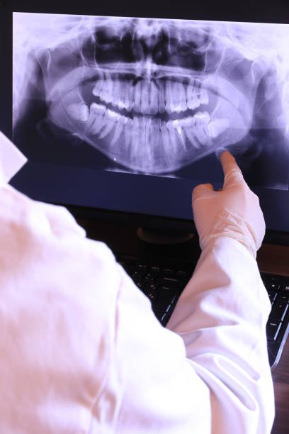 Best Emergency Dental Care for Broken or Chipped Teeth in Fannett, TX