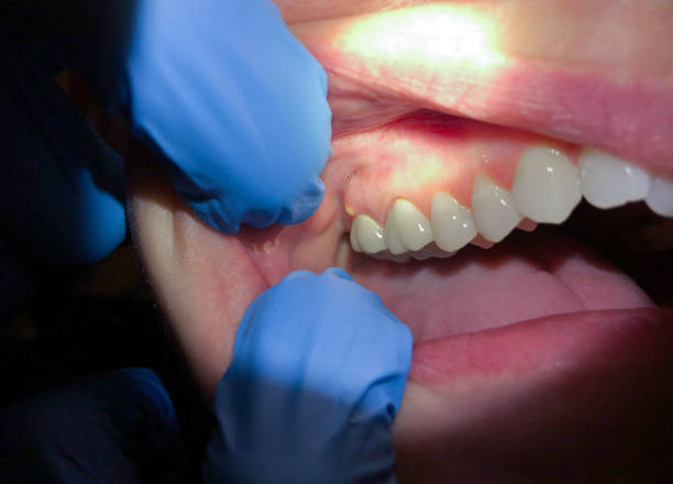 Best Same-Day Emergency Dental Services in Fannett, TX