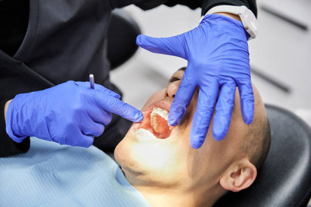 Best Emergency Tooth Extraction in Fannett, TX