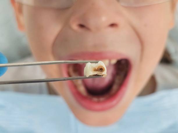 Best Emergency TMJ Treatment in Fannett, TX